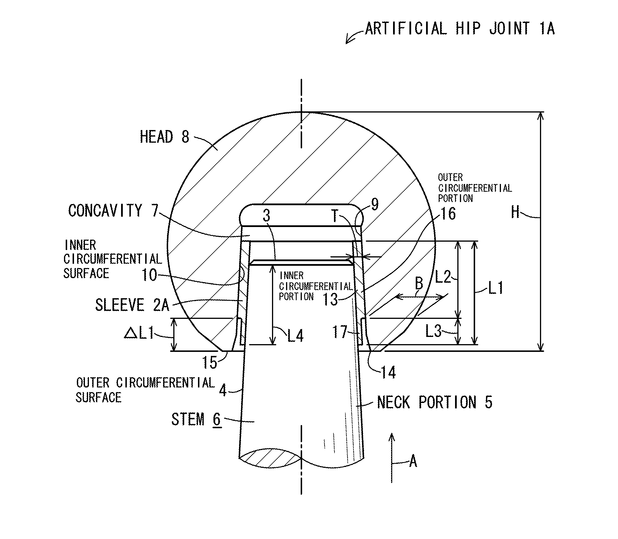 Artificial hip joint