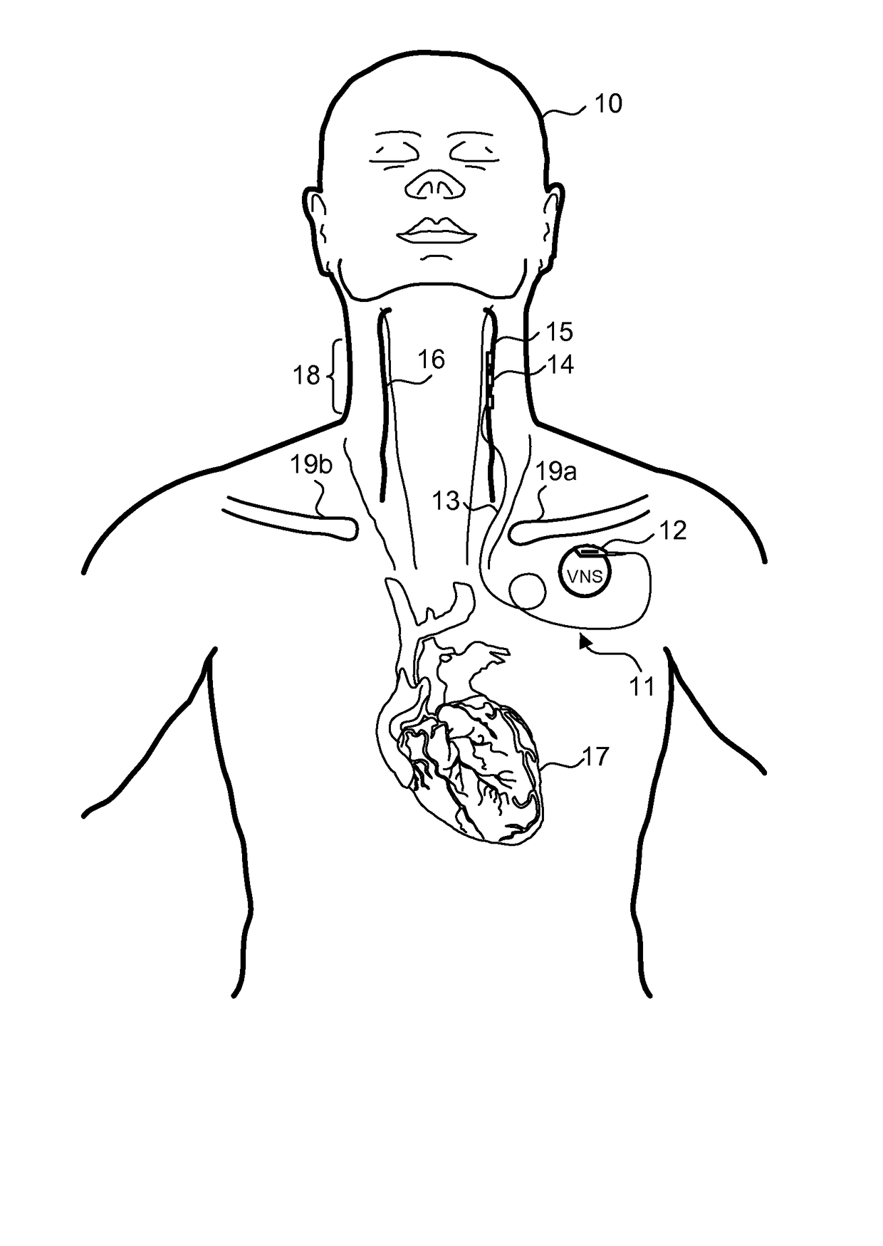 Implantable neurostimulator-implemented method for enhancing post-exercise recovery through vagus nerve stimulation