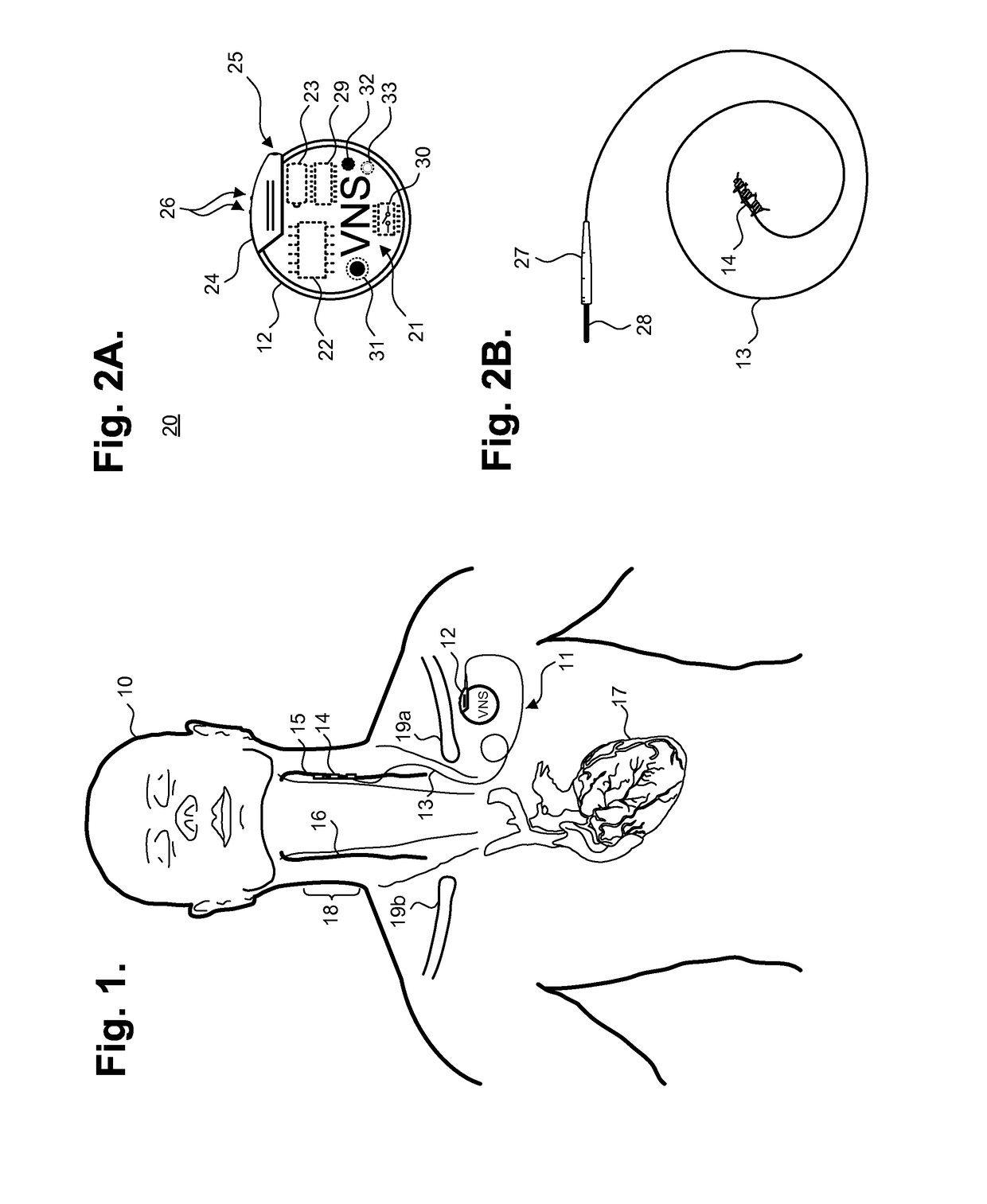 Implantable neurostimulator-implemented method for enhancing post-exercise recovery through vagus nerve stimulation