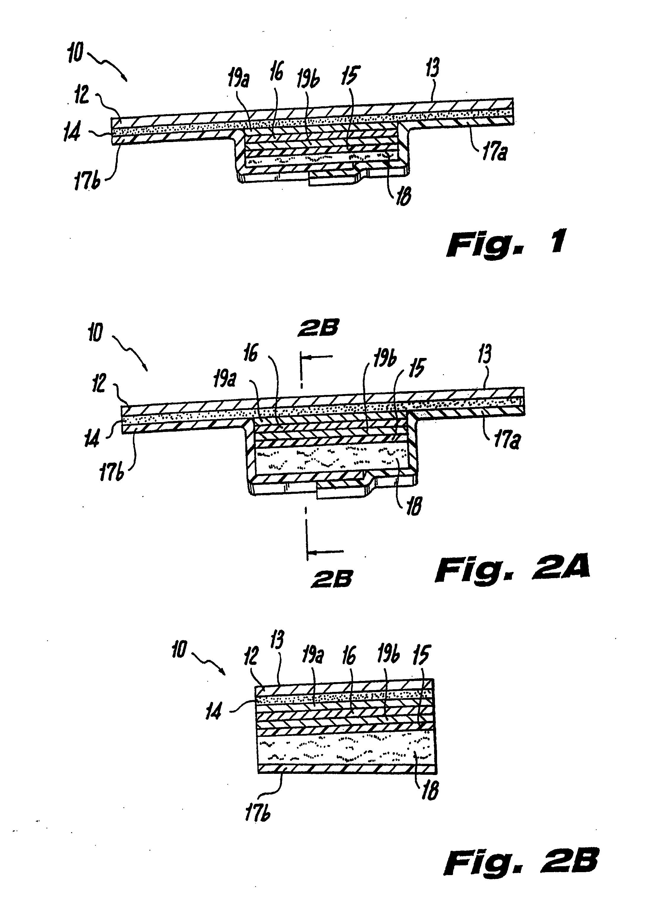 Ultrasound bandage