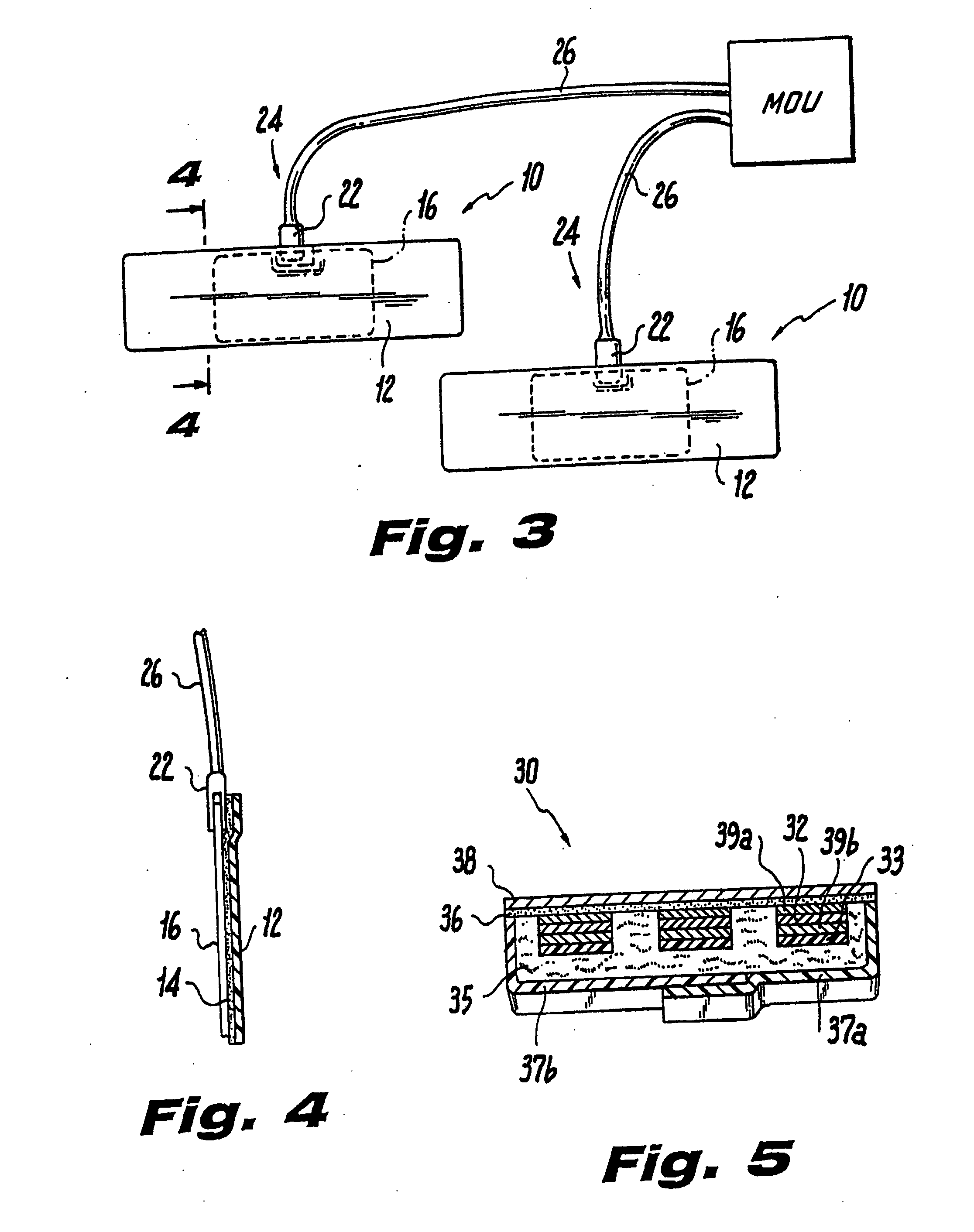 Ultrasound bandage