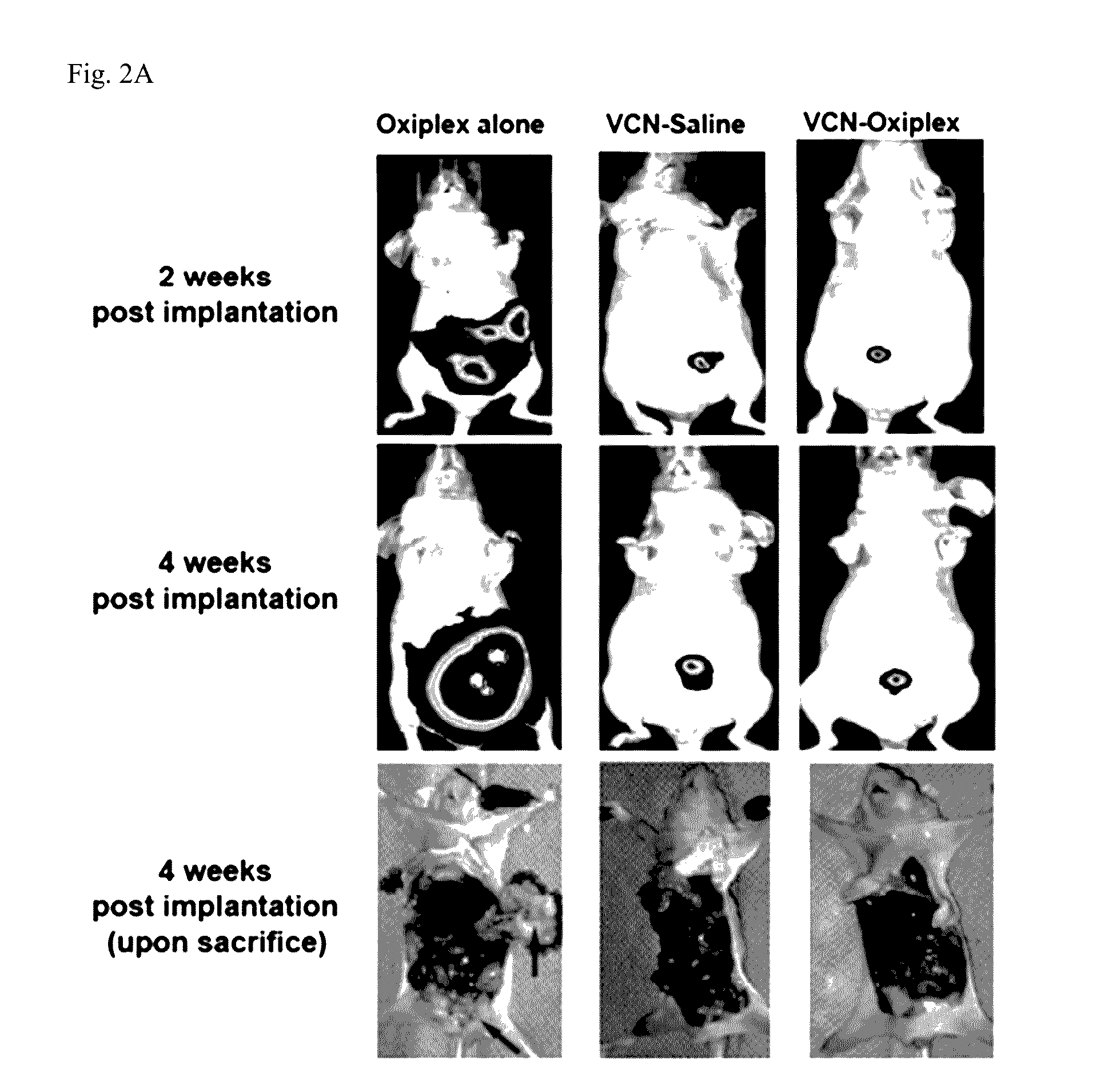 Compositions and methods for treating ovarian cancer including preventing the recurrence thereof