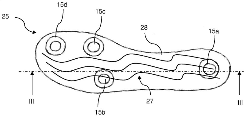 Sensor support for arranging on a prosthesis