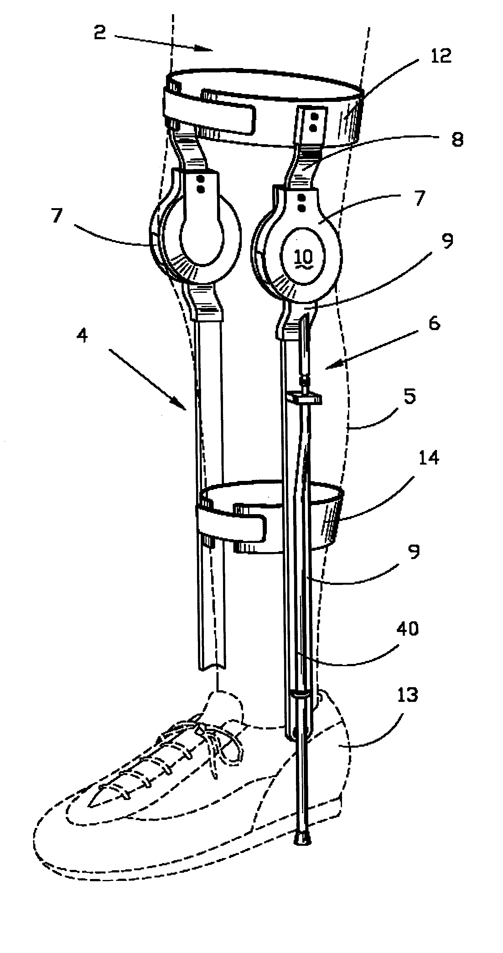 Orthopedic leg brace