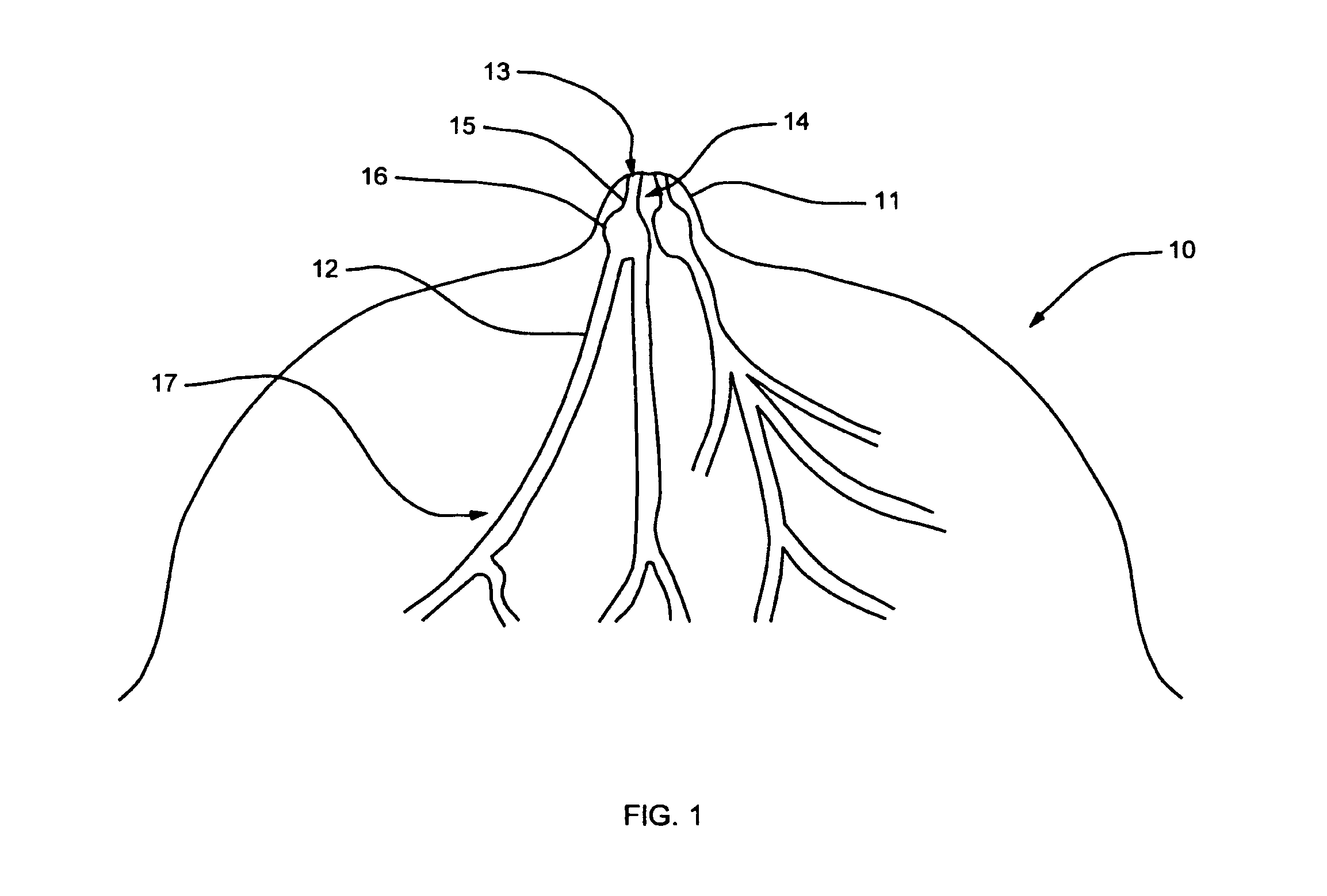 Methods and devices for delivery of agents to breast milk ducts