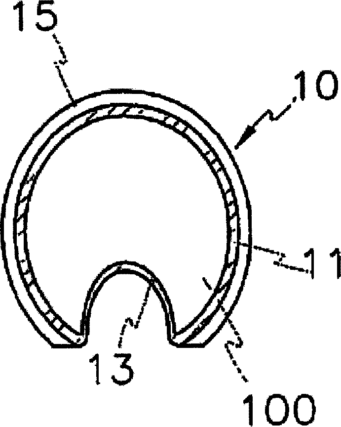 Endoprosthesis