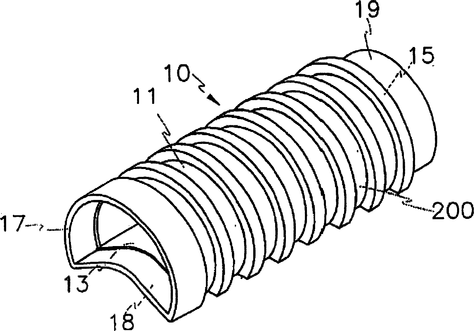 Endoprosthesis