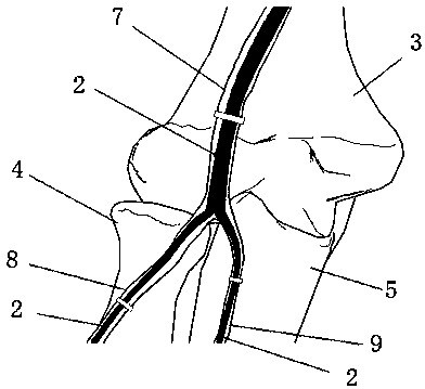 A method for producing bone and soft tissue X-ray imaging images