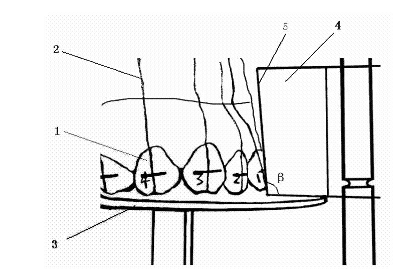 Method for manufacturing personalized tongue side corrector and tongue side corrector