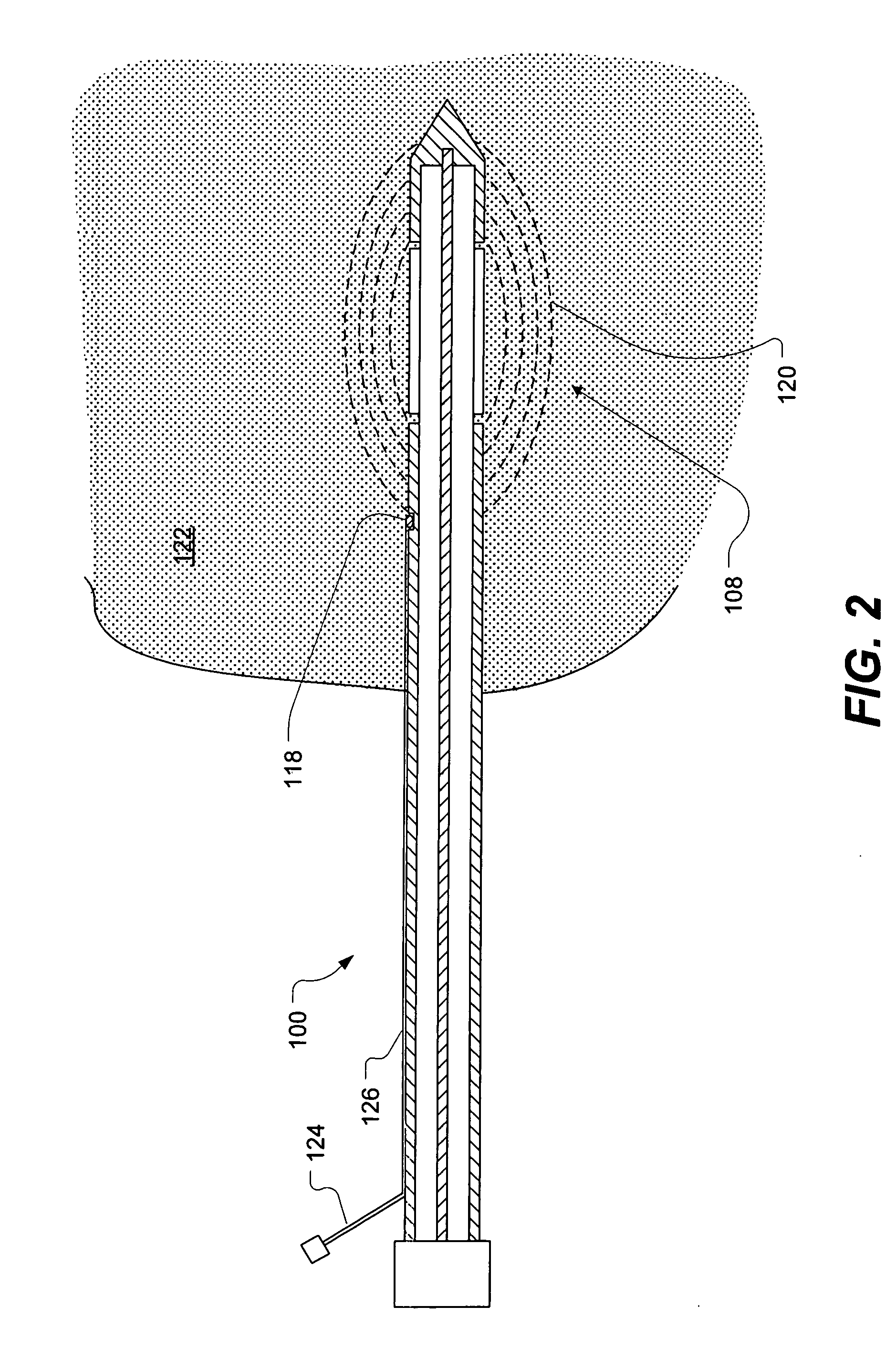 Microwave applicator with adjustable heating length