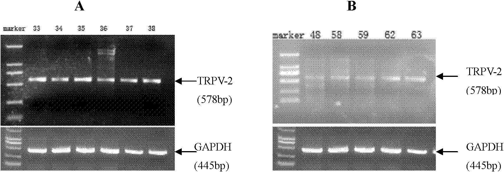 Marker for detecting pediatric asthma