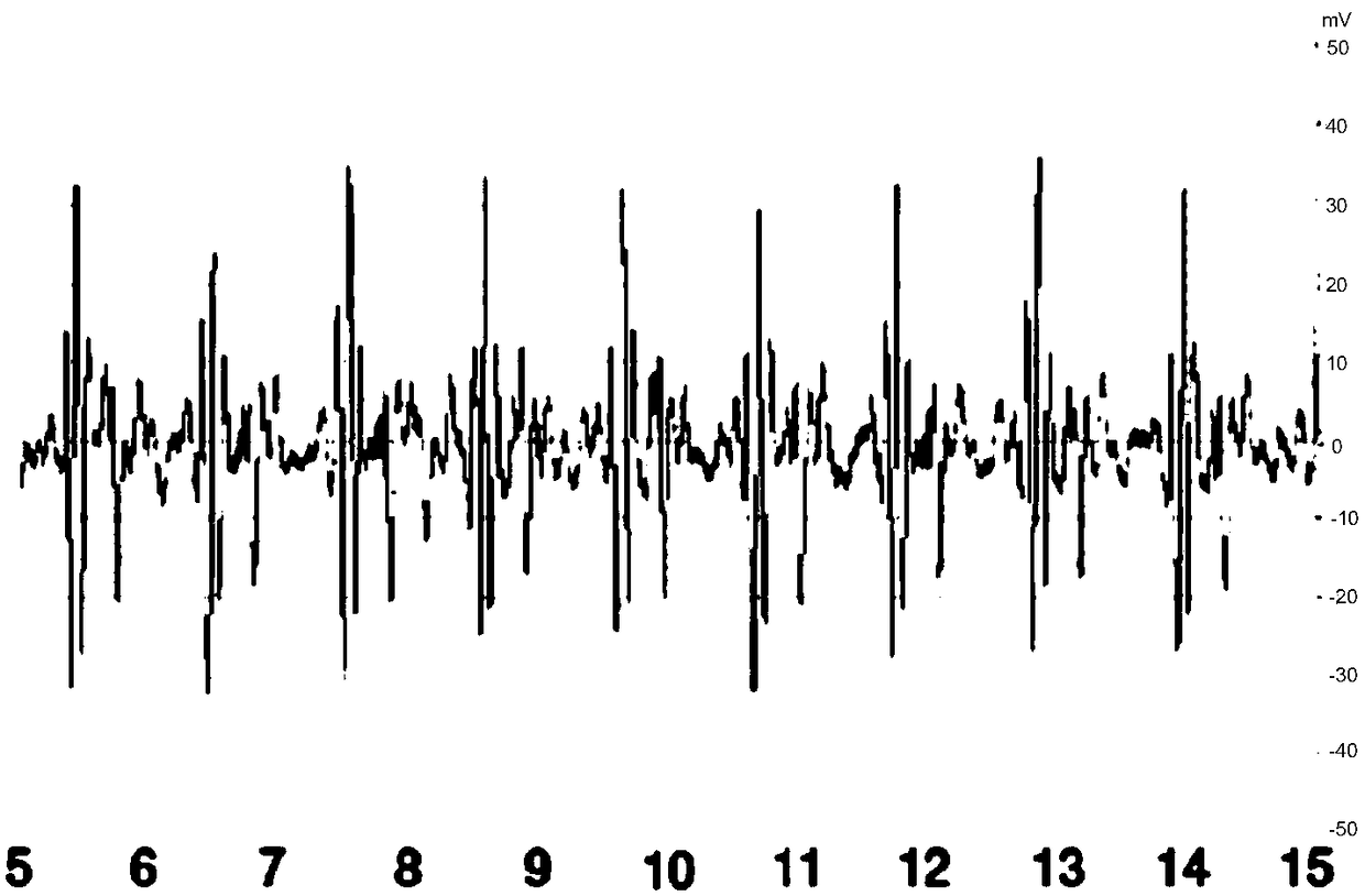 Animal heart sound signal acquisition device and acquisition system