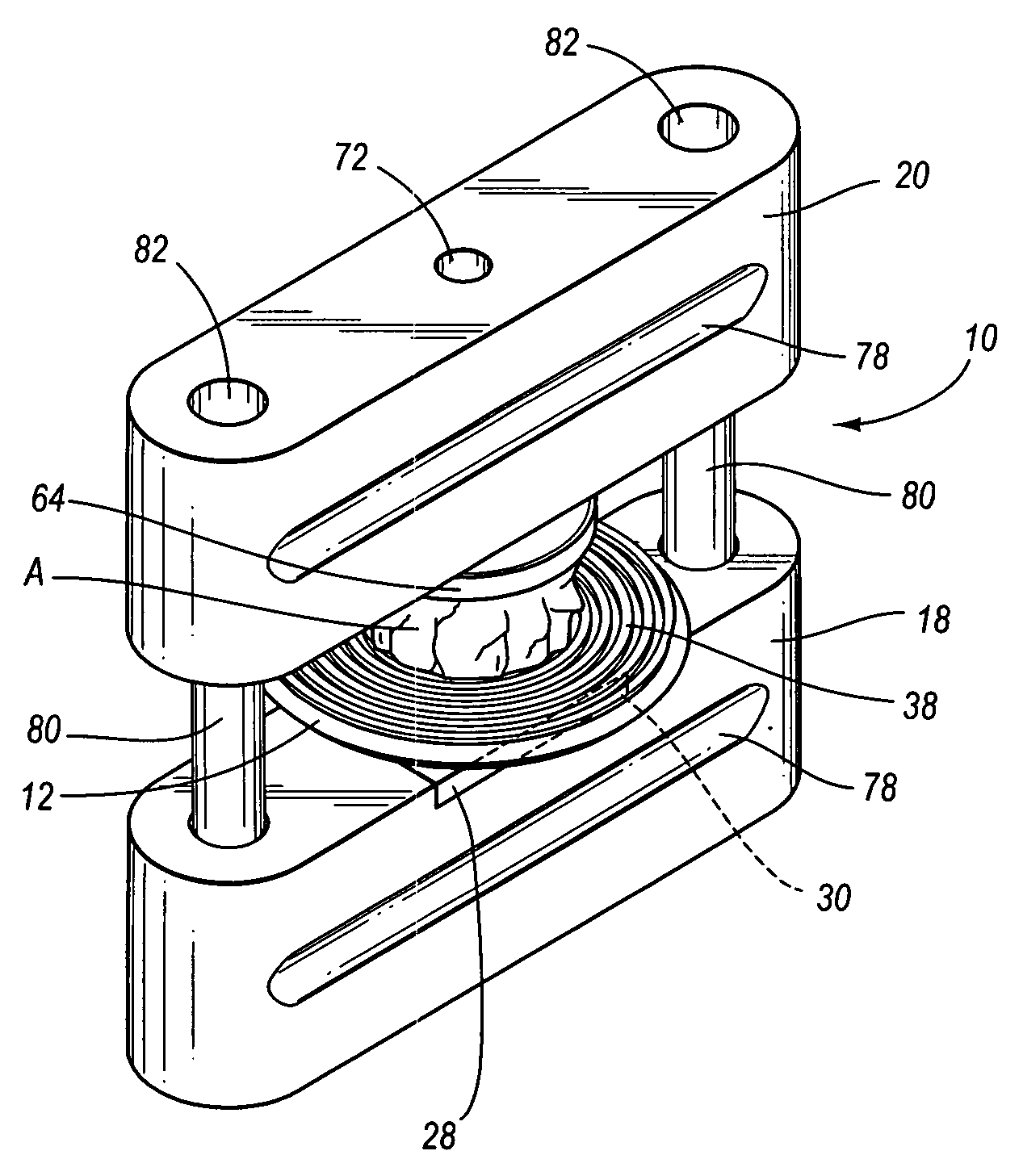 System for preparing cutaneous tissue samples for oncological histology study and diagnosis