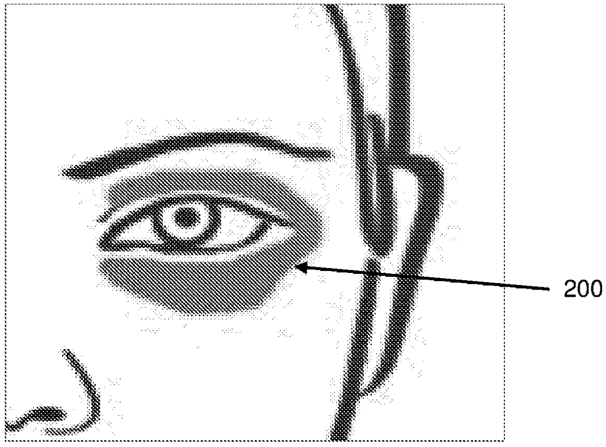 Method of improving the appearance of periorbital dyschromia