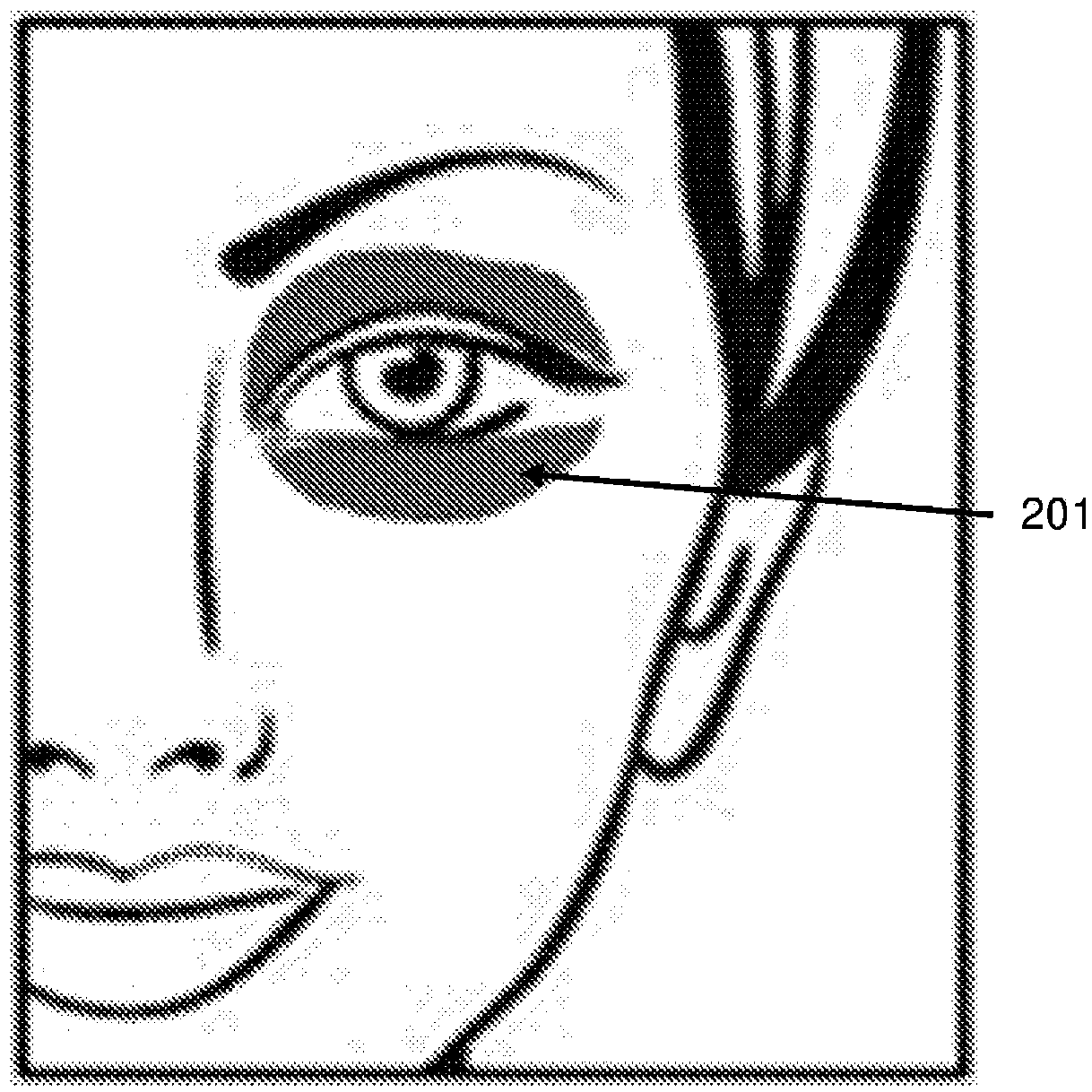 Method of improving the appearance of periorbital dyschromia