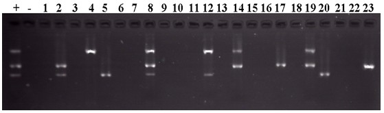 Kit for detecting cysticercus cellulosae, swine trichinella and swine toxoplasmosis and application