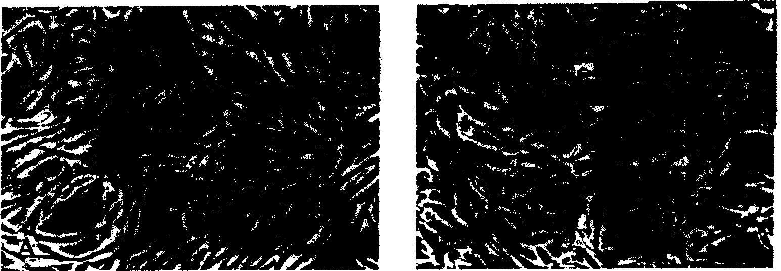 Method for inducing fibroblast to form cartilage cells