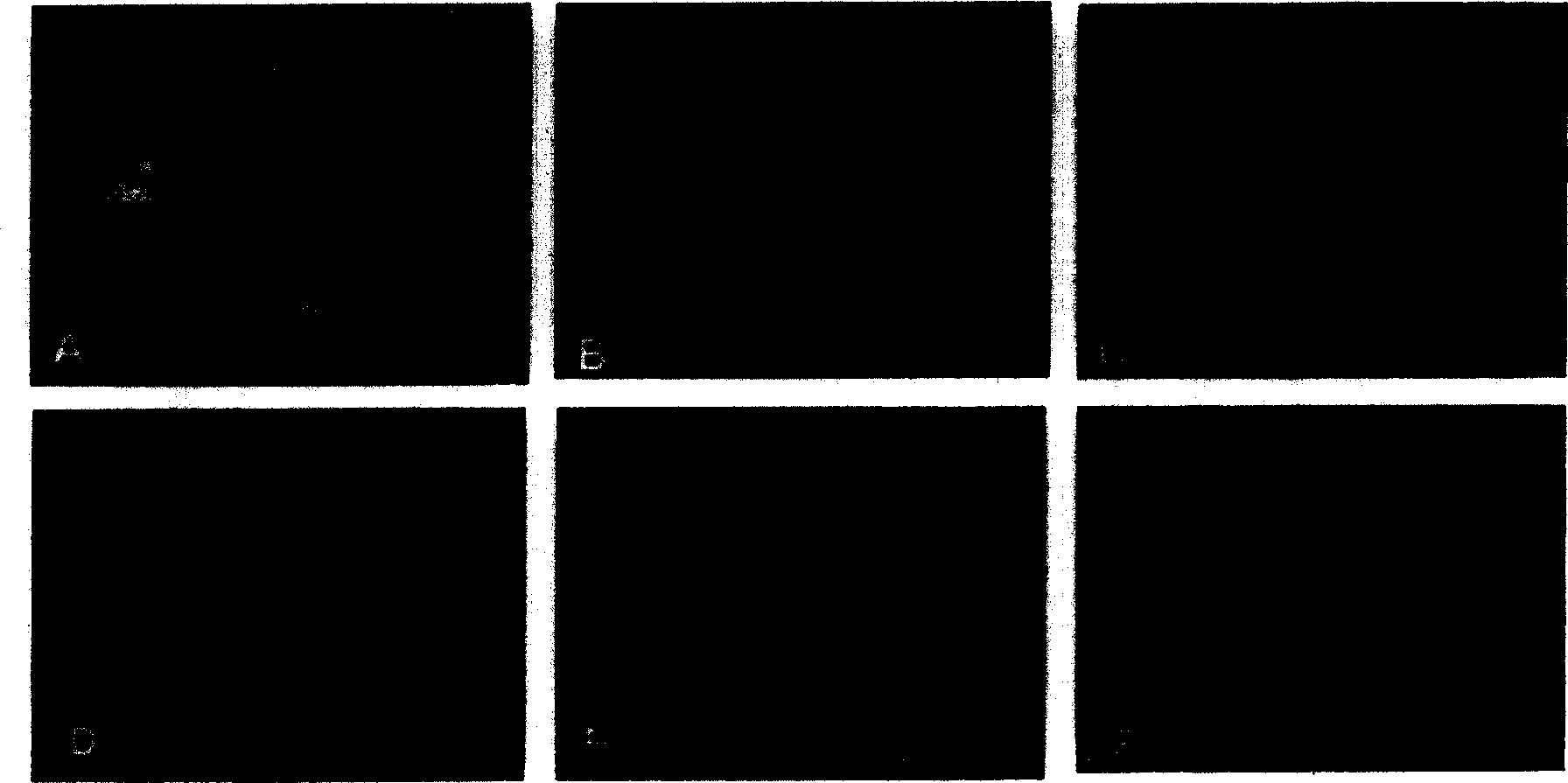 Method for inducing fibroblast to form cartilage cells