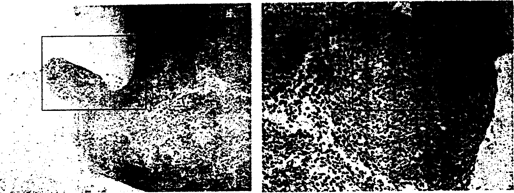 Method for inducing fibroblast to form cartilage cells