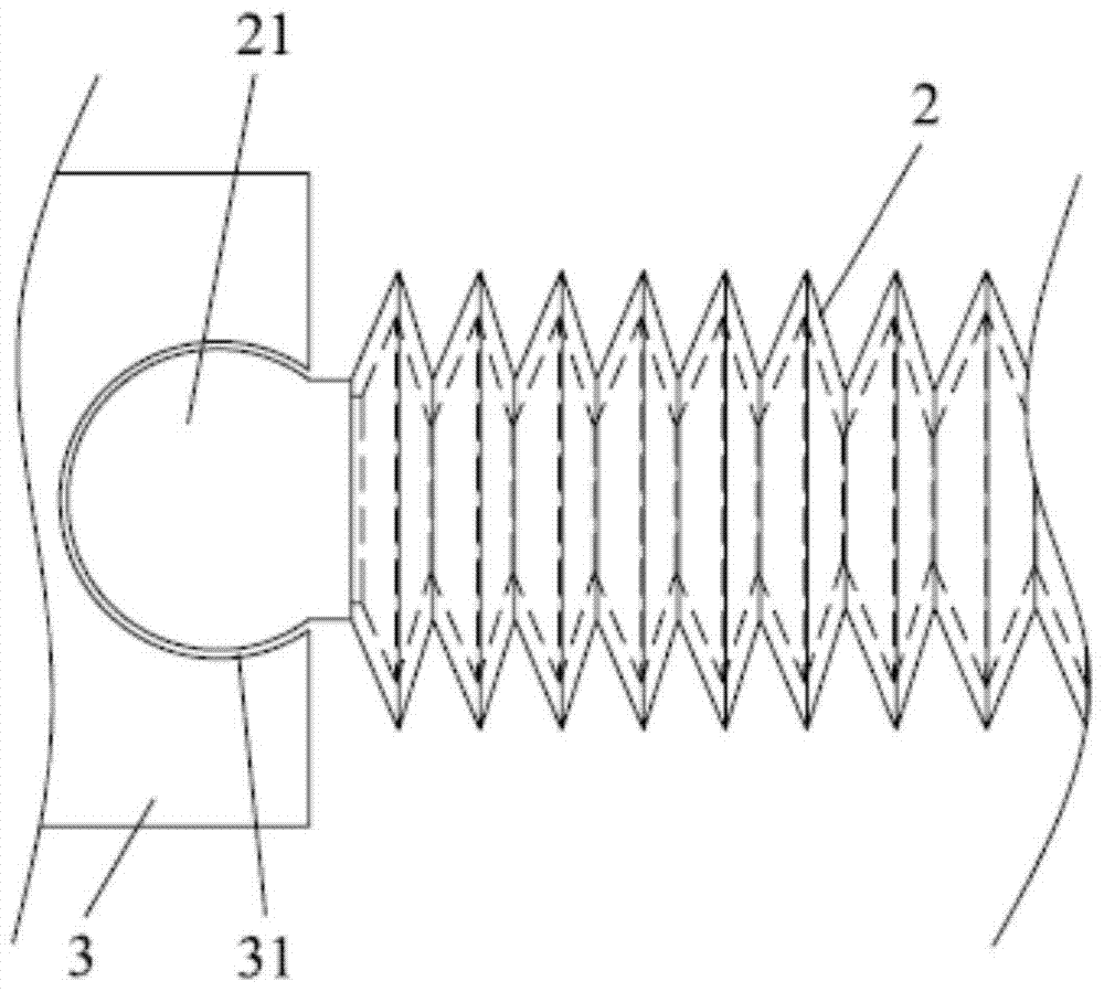 A transcatheter left atrial appendage closure system