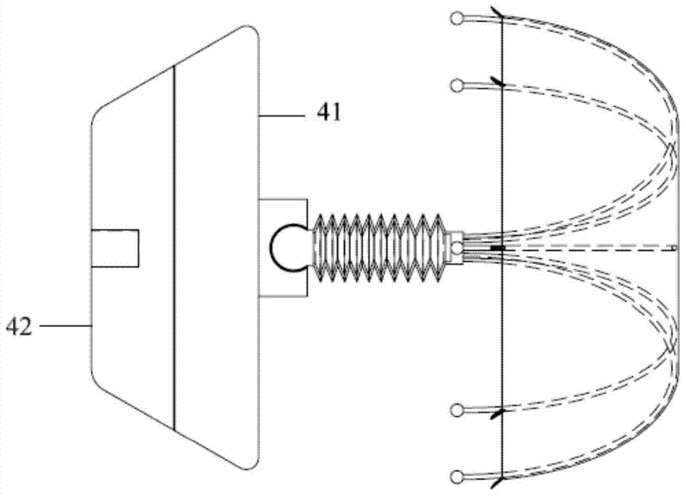 A transcatheter left atrial appendage closure system