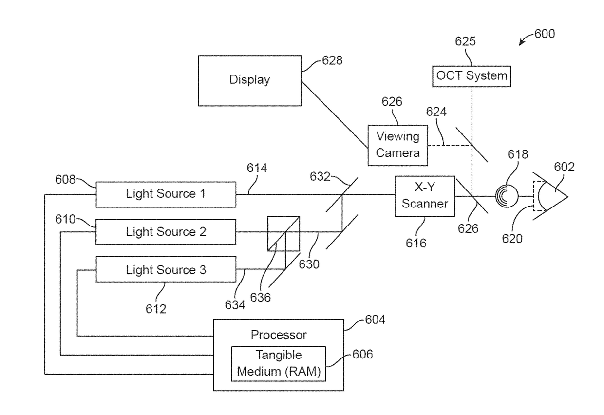 Glaucoma treatment  methods and apparatus