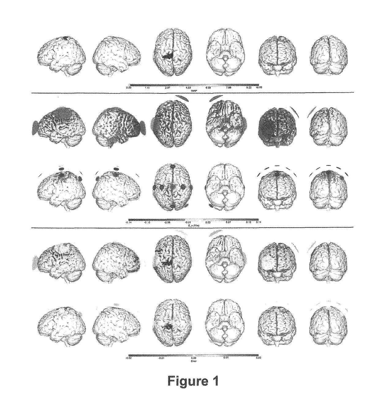 Method and a system for optimizing the configuration of multisite transcranial current stimulation and a computer-readable medium