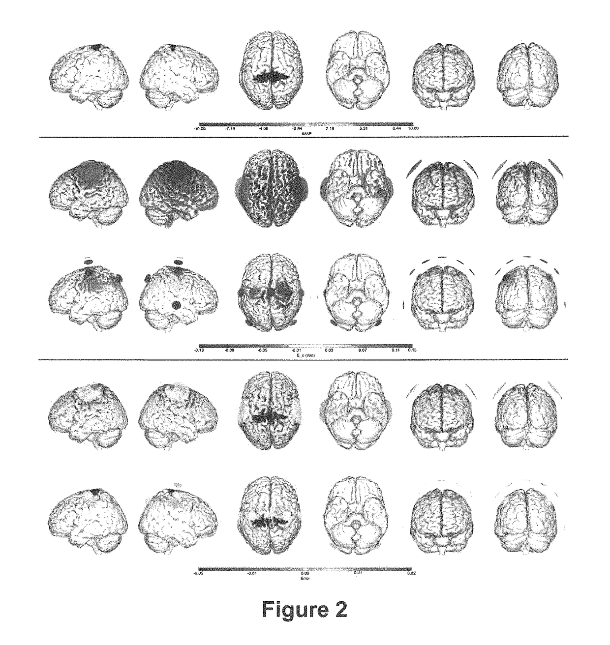 Method and a system for optimizing the configuration of multisite transcranial current stimulation and a computer-readable medium