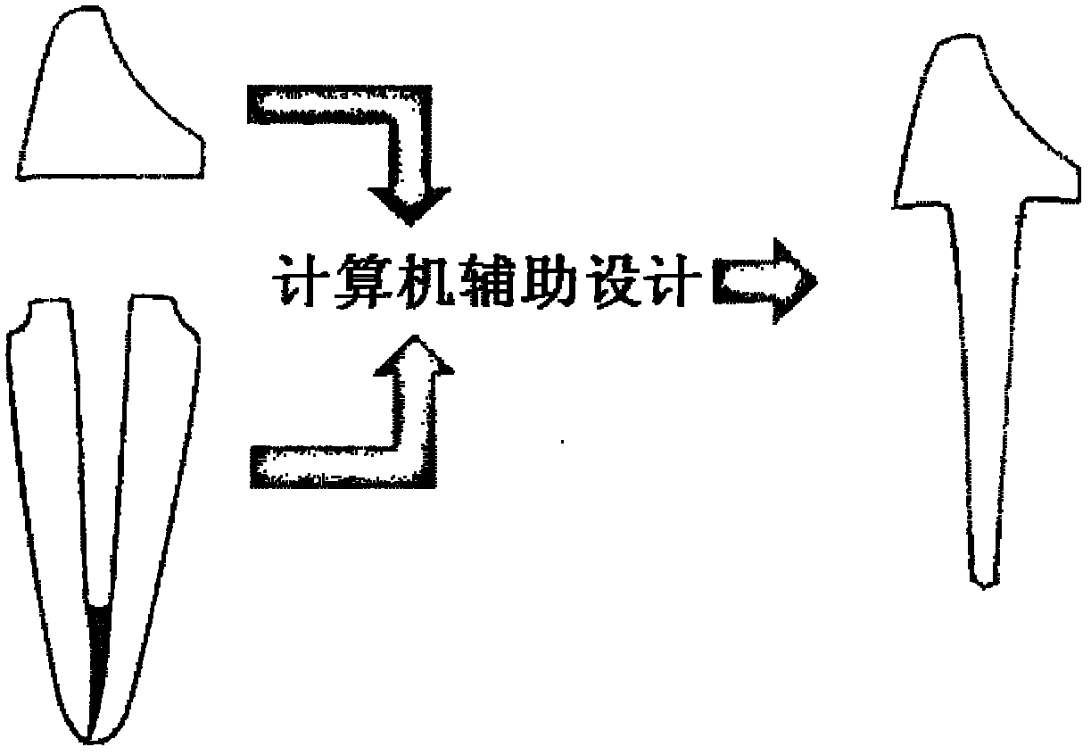 Computer-aided design making method for dental personalized integrated non-metal post core