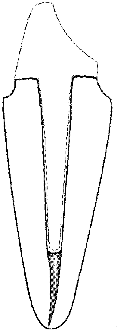 Computer-aided design making method for dental personalized integrated non-metal post core