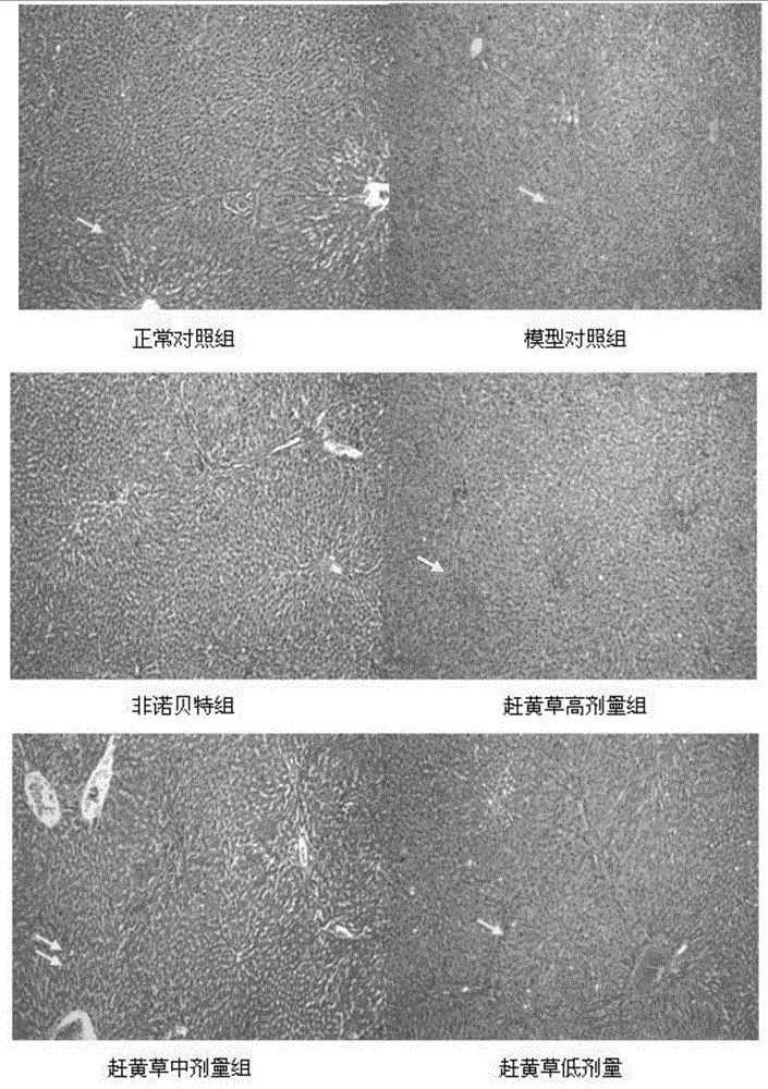 New use of penthorum chinense pursh or extract thereof