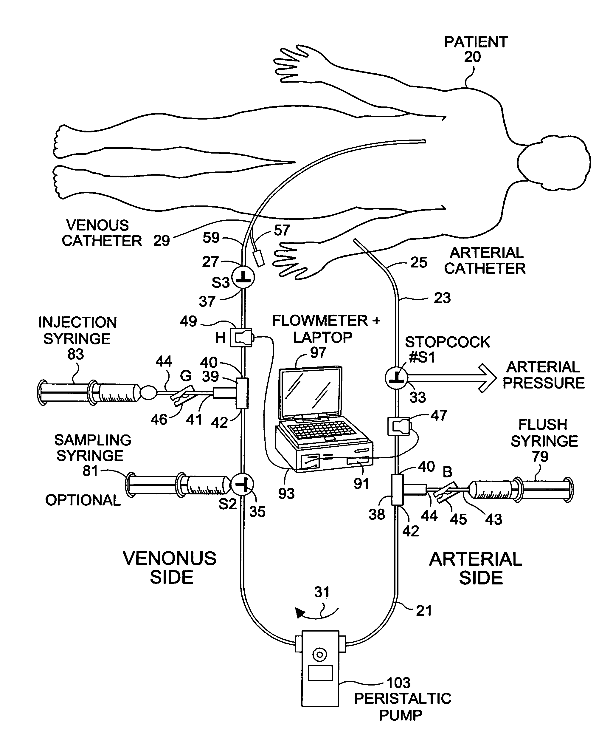 System and method for diverting flow to facilitate measurement of system parameters