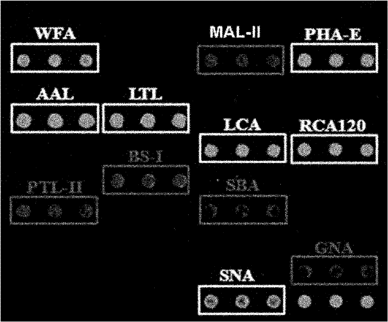 Method for detecting alternative biological markers of liver neoplasms in saliva, serum and urine