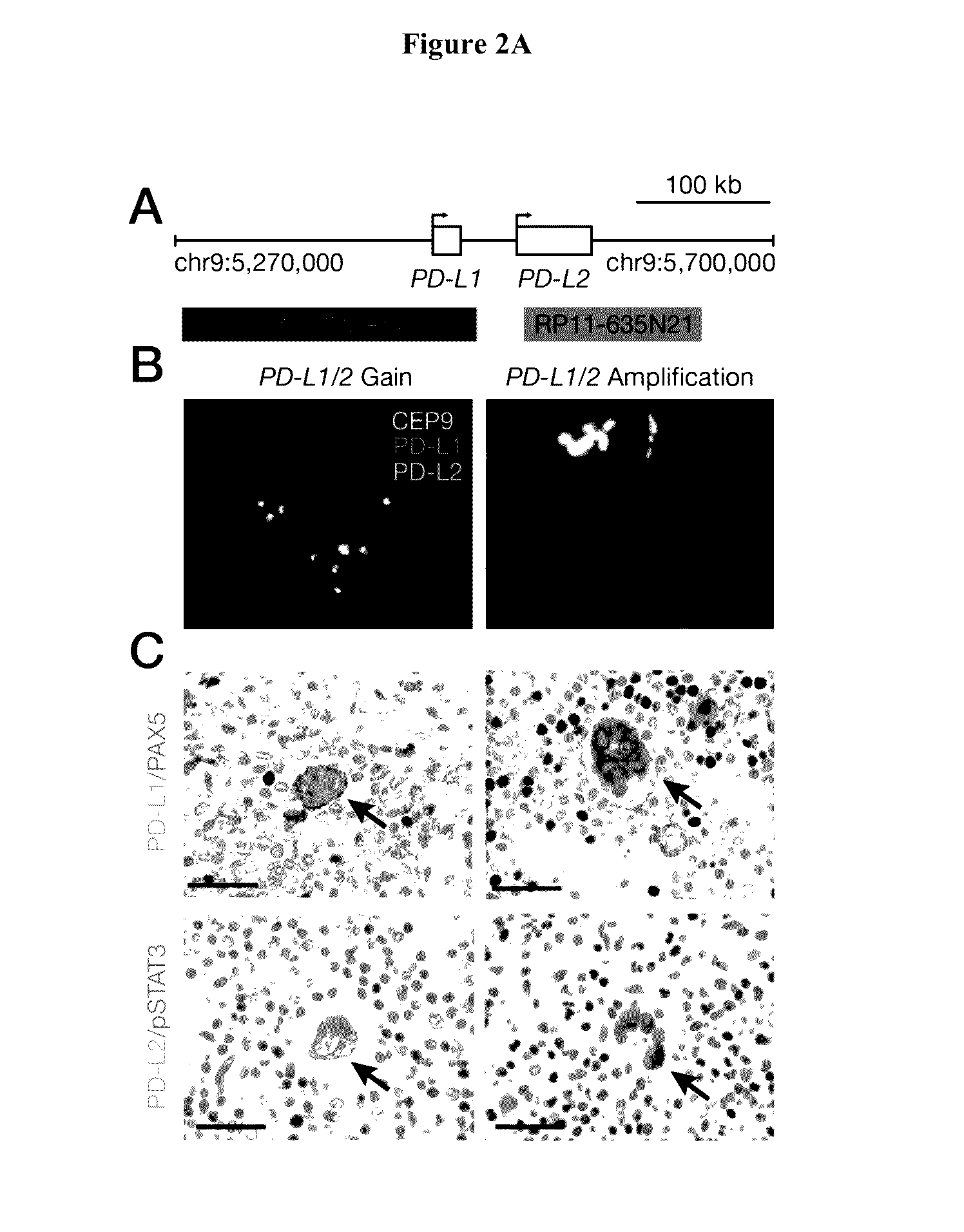 Treatment of hodgkin's lymphoma using an Anti-pd-1 antibody