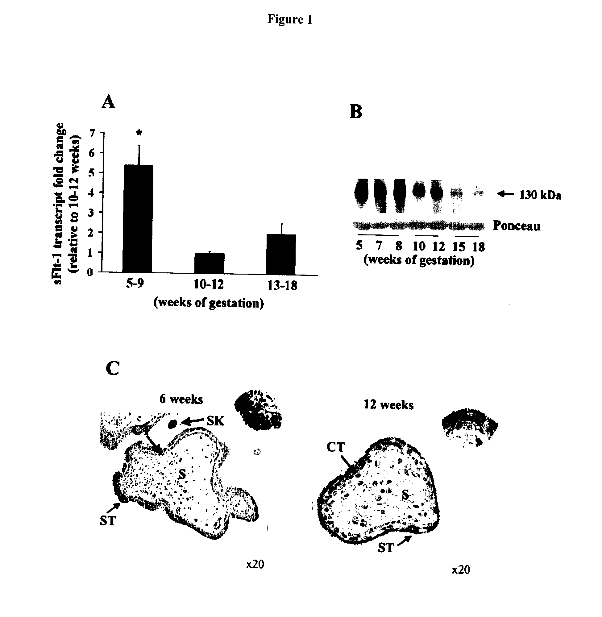 Diagnostic compositions and treatment methods for conditions involving trophoblast cell death, differentiation, invasion and/or cell fusion and turnover