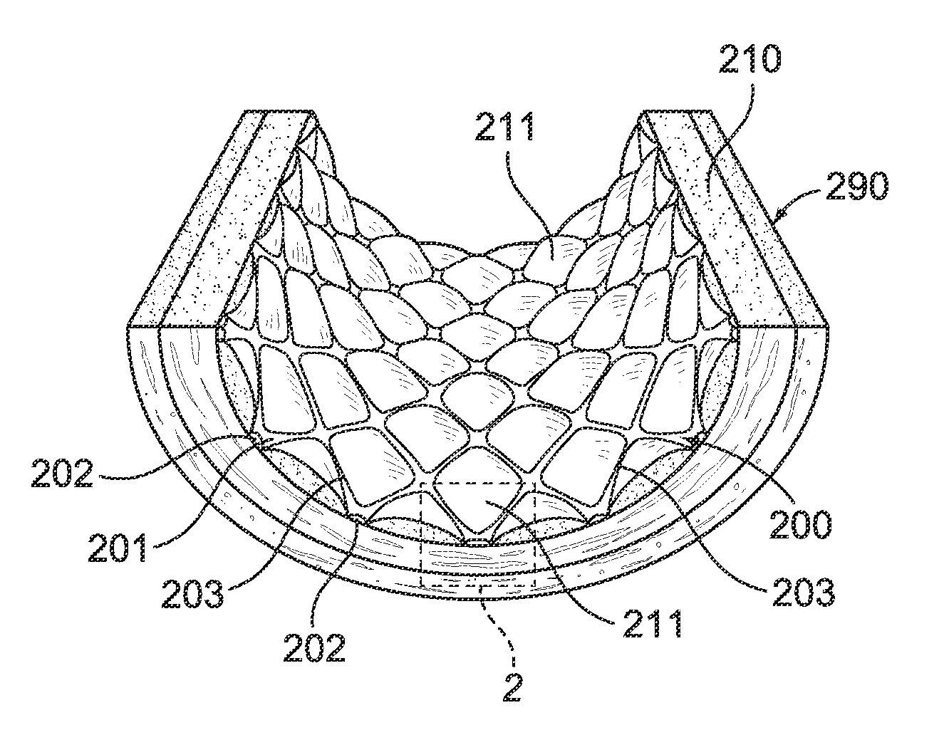 Grooved drug-eluting medical devices and method of making same