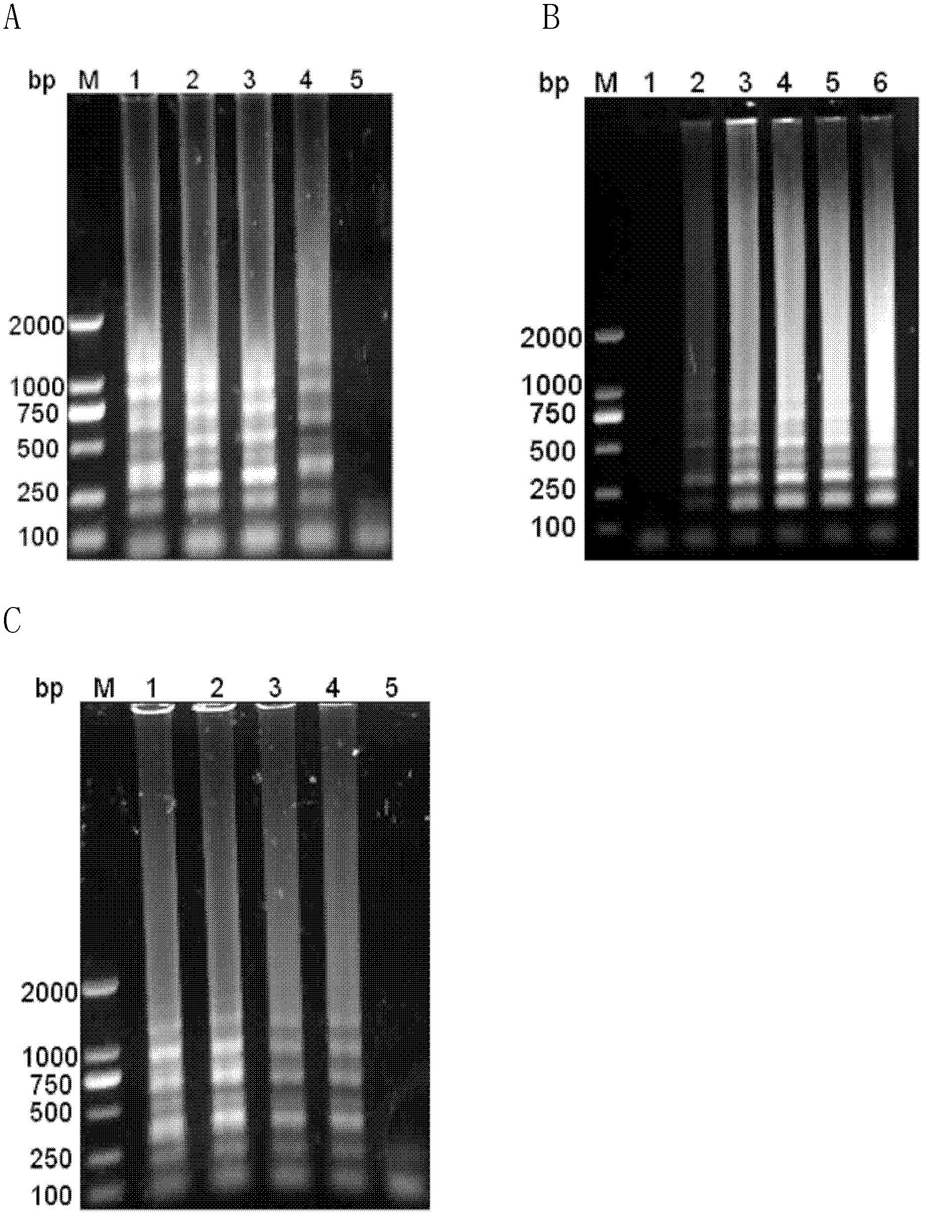 Reverse transcription loop-mediated isothermal amplification (RT-LAMP) visual kit for detecting Japanese B encephalitis virus and application of kit