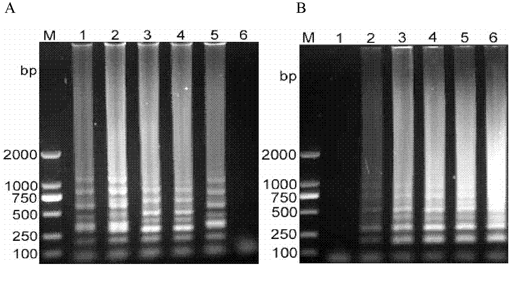 Reverse transcription loop-mediated isothermal amplification (RT-LAMP) visual kit for detecting Japanese B encephalitis virus and application of kit