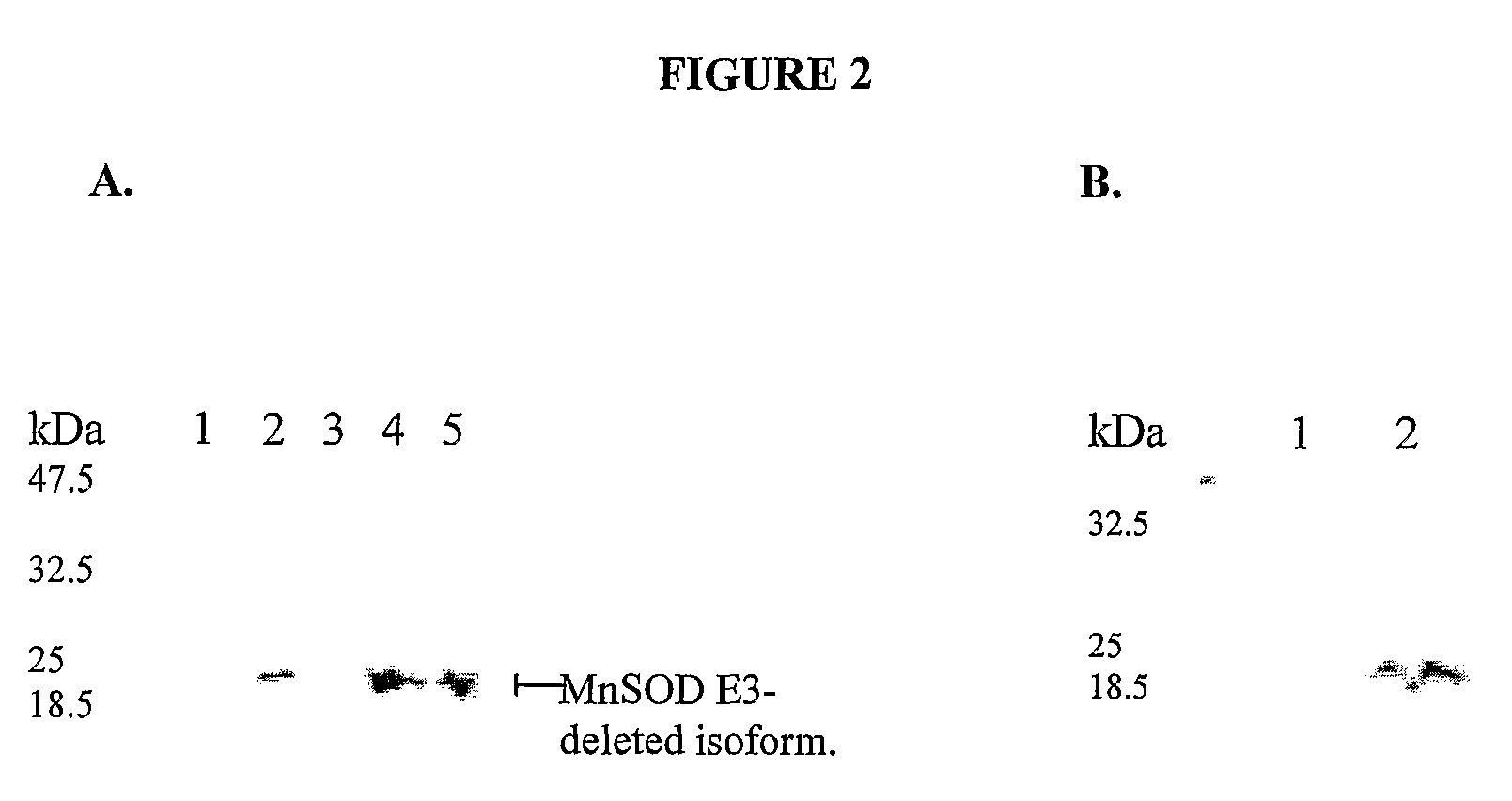 Compositions and methods for inhibiting an isoform of human manganese superoxide dismutase