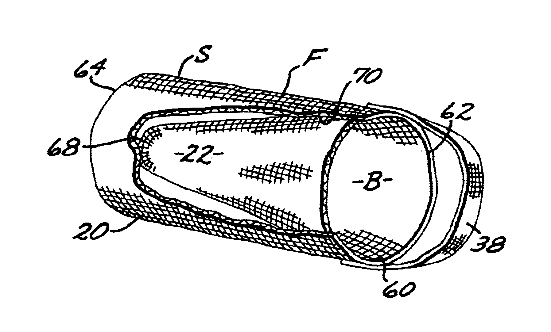 Spa and pool filter