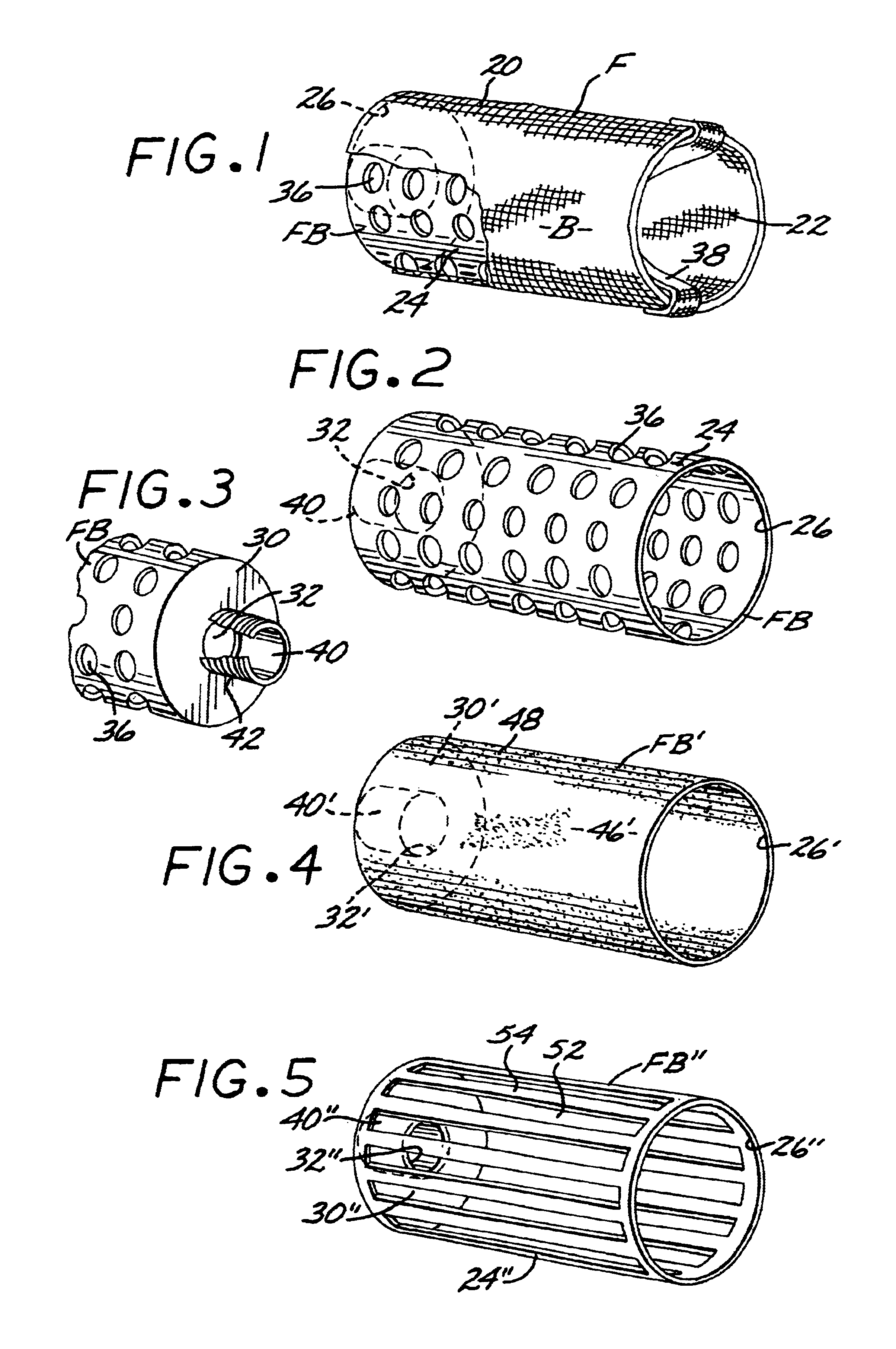 Spa and pool filter