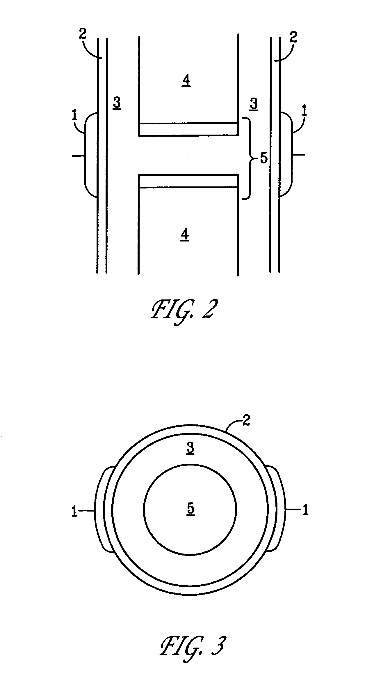 Method and device for treating osteoarthritis, cartilage disease, defects and injuries in the human knee