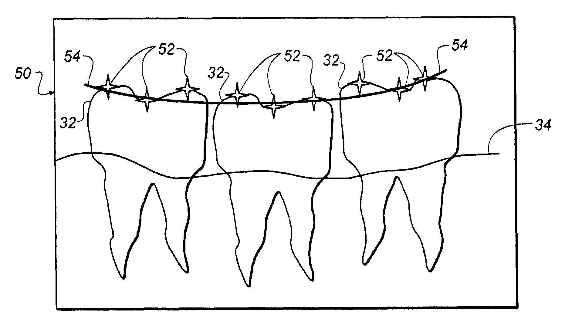 Method for determining dental alignment using radiographs