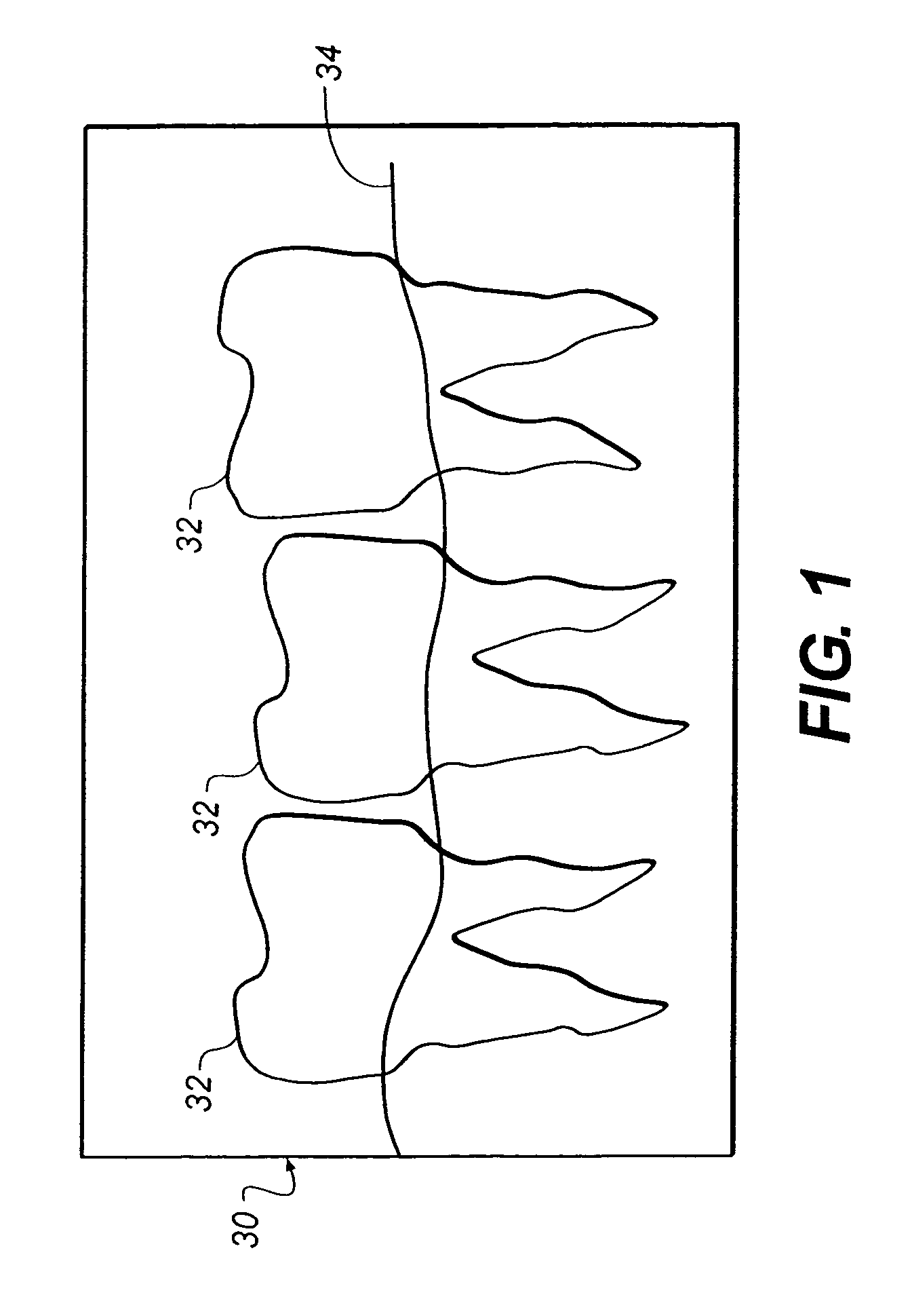 Method for determining dental alignment using radiographs