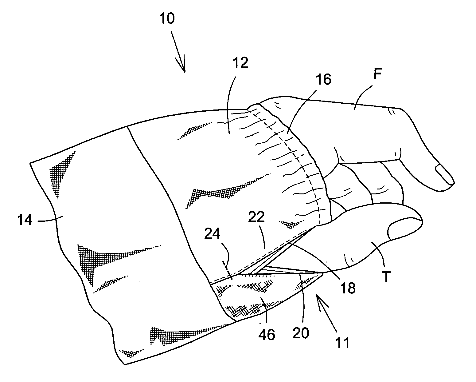 Garment element with an access opening