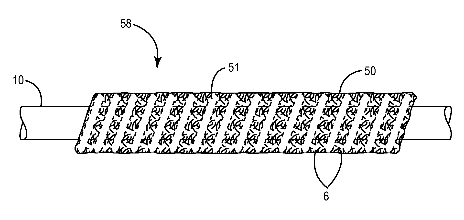 Medical electrical electrodes with conductive polymer