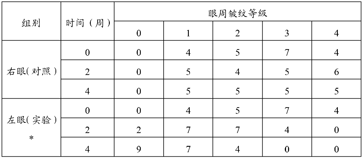 Alchemilla vulgaris extract as well as preparation method and application thereof in resisting wrinkle and whitening