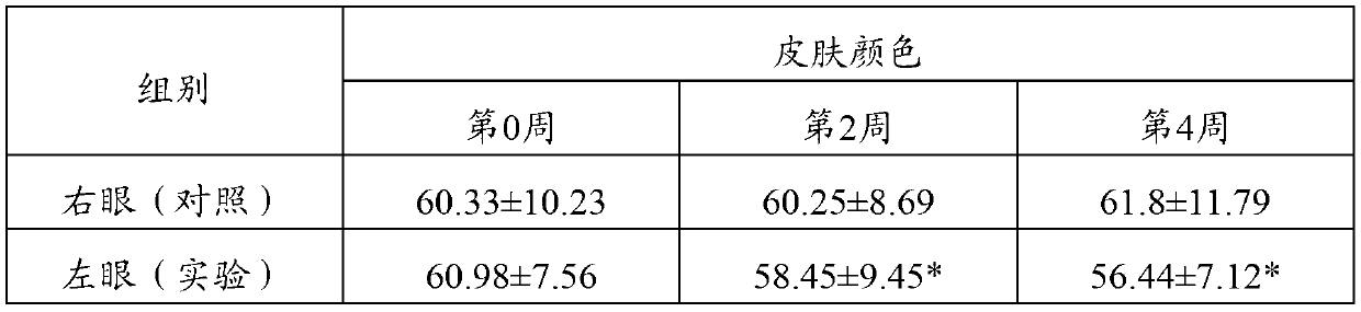 Alchemilla vulgaris extract as well as preparation method and application thereof in resisting wrinkle and whitening