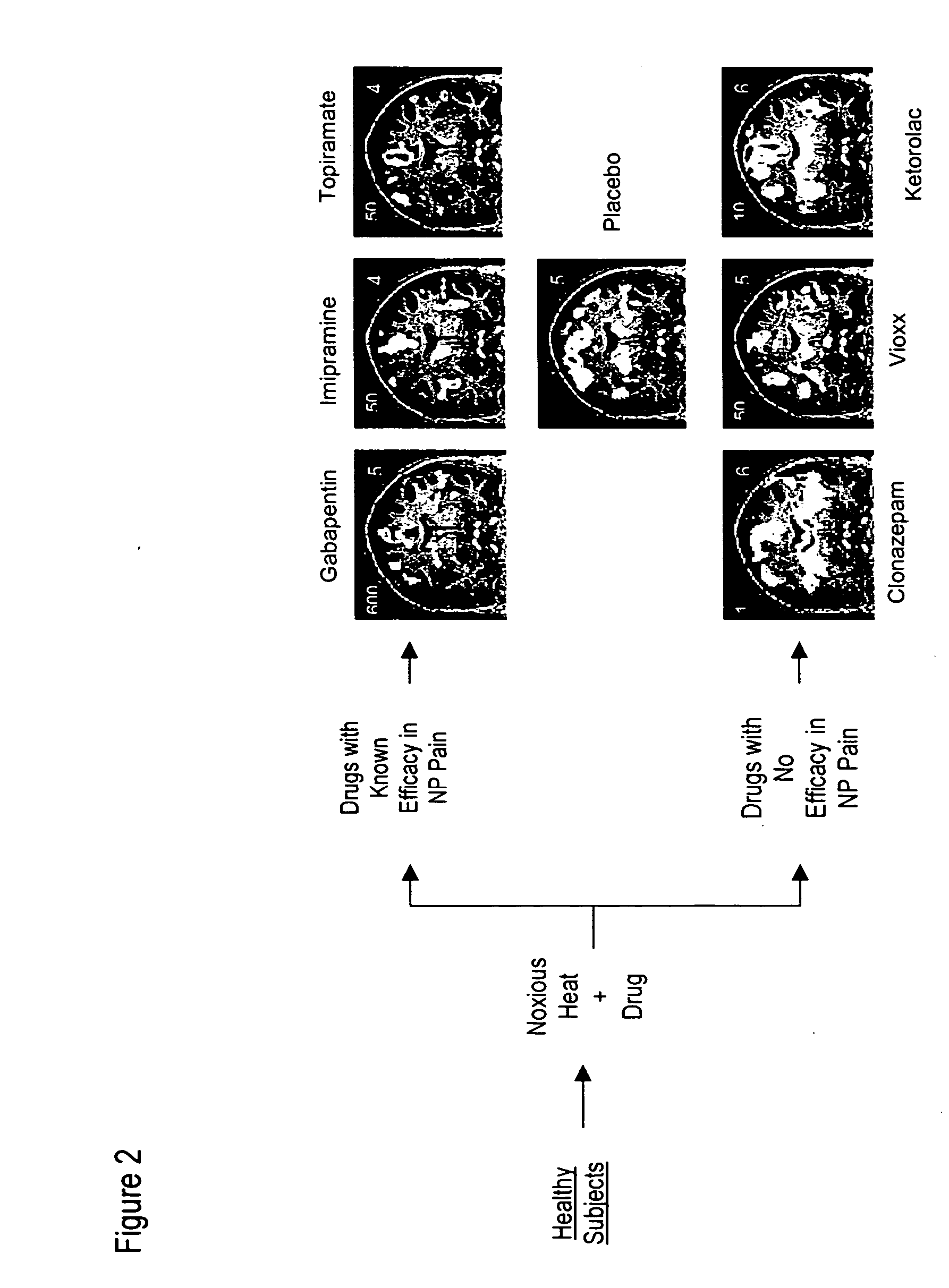 CNS assay for prediction of therapeutic efficacy for neuropathic pain and other functional illnesses