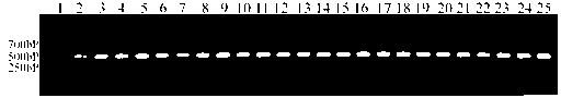 Apolipoprotein B nano antibody and coding sequence and application thereof